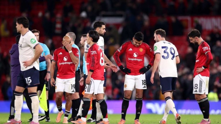 Fan de Manchester United partage une attente inattendue après s’être rasé les cheveux